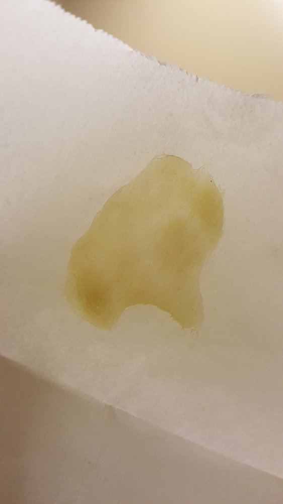 20160316 092906