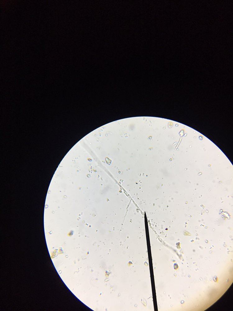 Aact   is this fungal hyphae microscopy 2