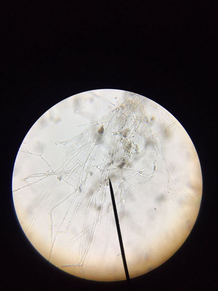 Aact   is this fungal hyphae microscopy 3