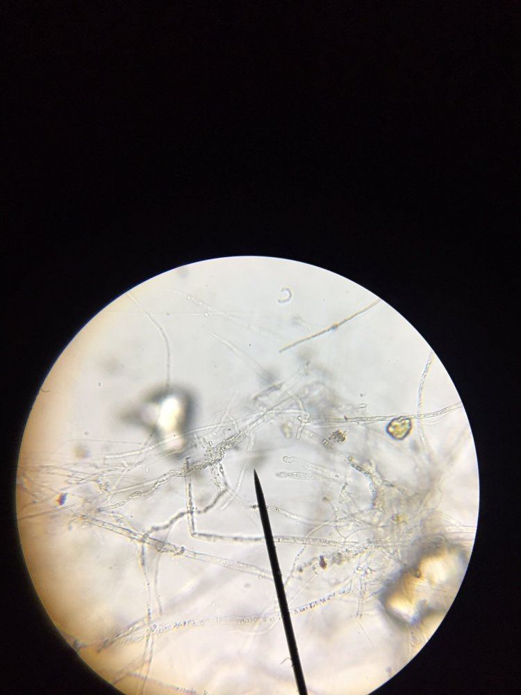 Aact   is this fungal hyphae microscopy 4