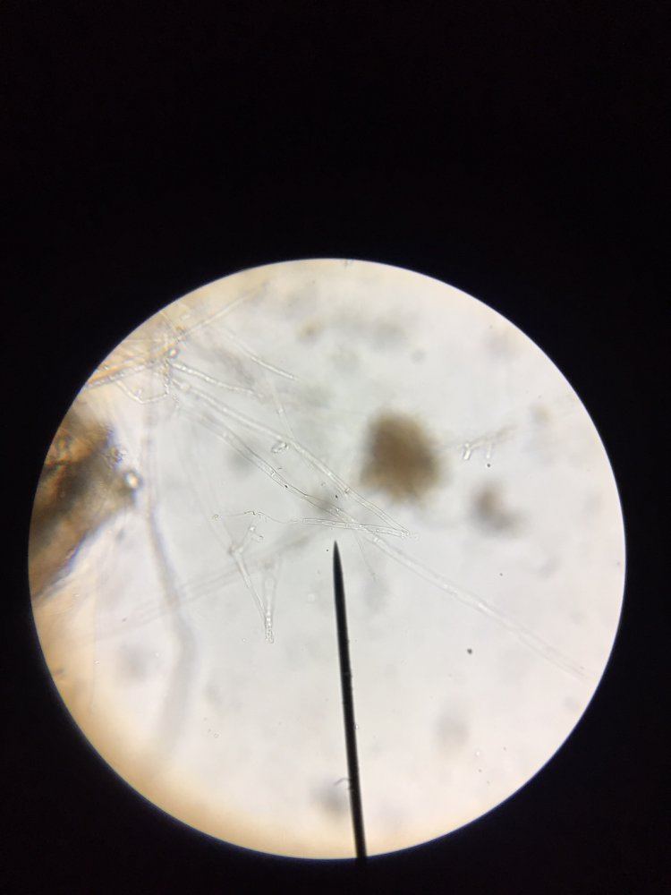 Aact   is this fungal hyphae microscopy 5