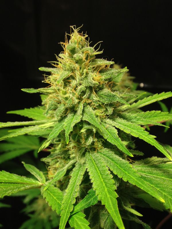 Anesthesia