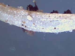 Are these root aphids 4