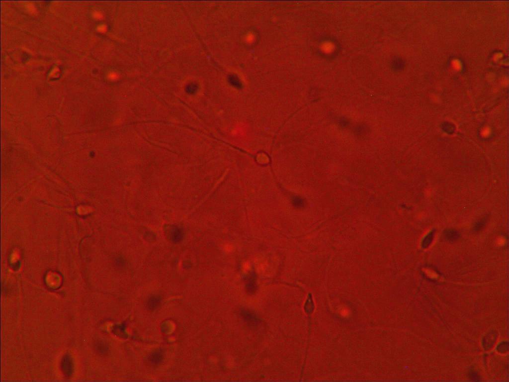 Bacteria1