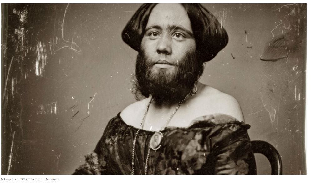 Bearded  woman