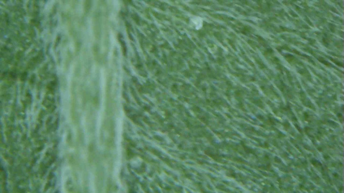 Bugs mites or am i just tripping