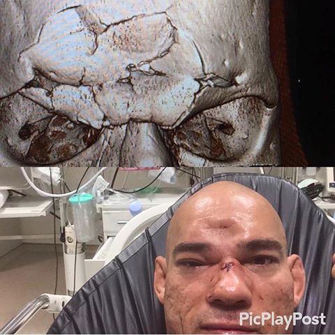 Cyborg