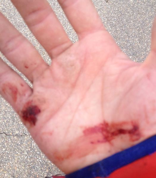 Hand