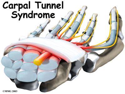 Hand carpal tunnel intro01