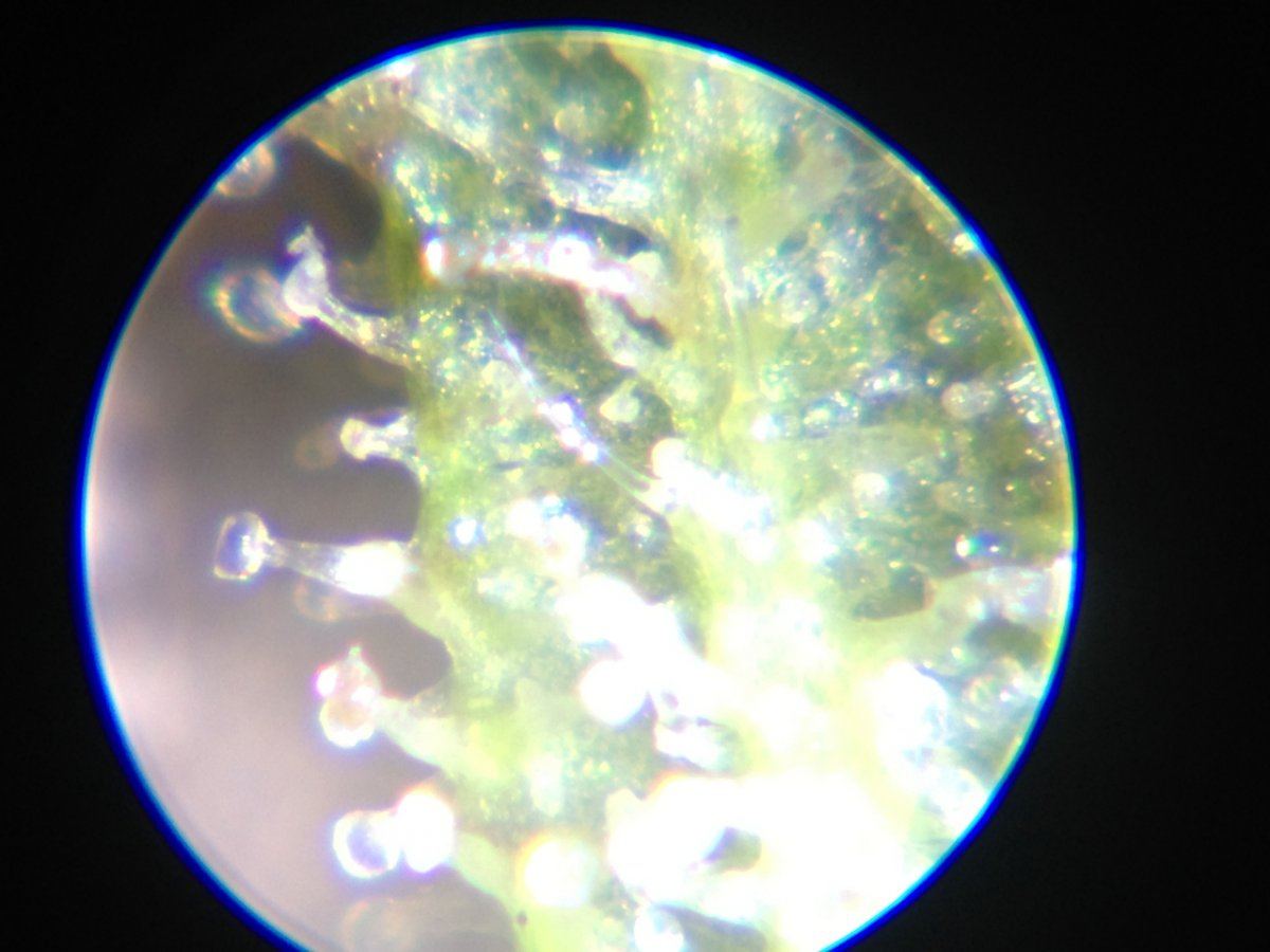 I want to get peak potency look at this trich under microscope