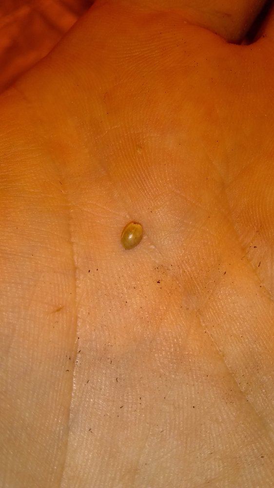 IMG 20181104 181217856