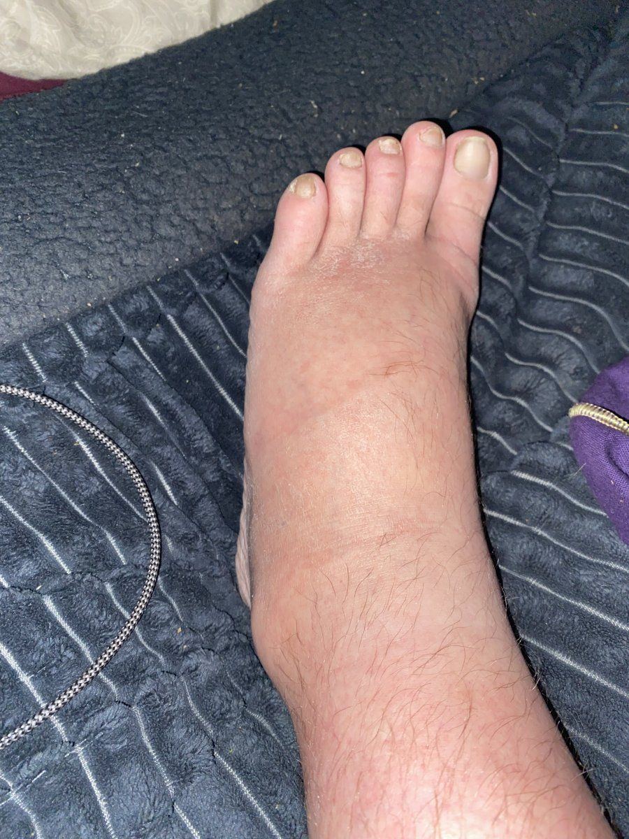 IMG 9366