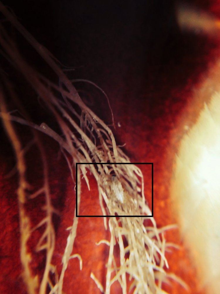 Root