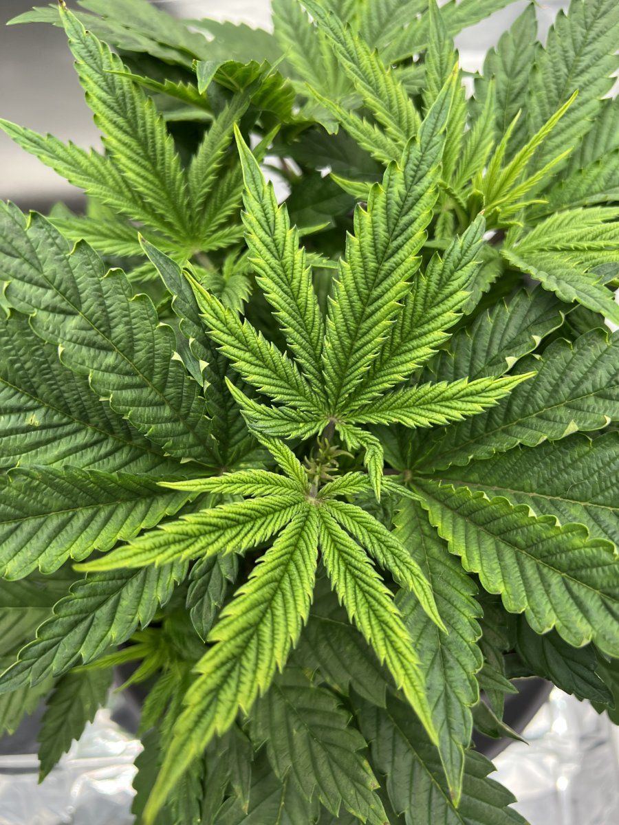 What nutrient deficiency is this 2