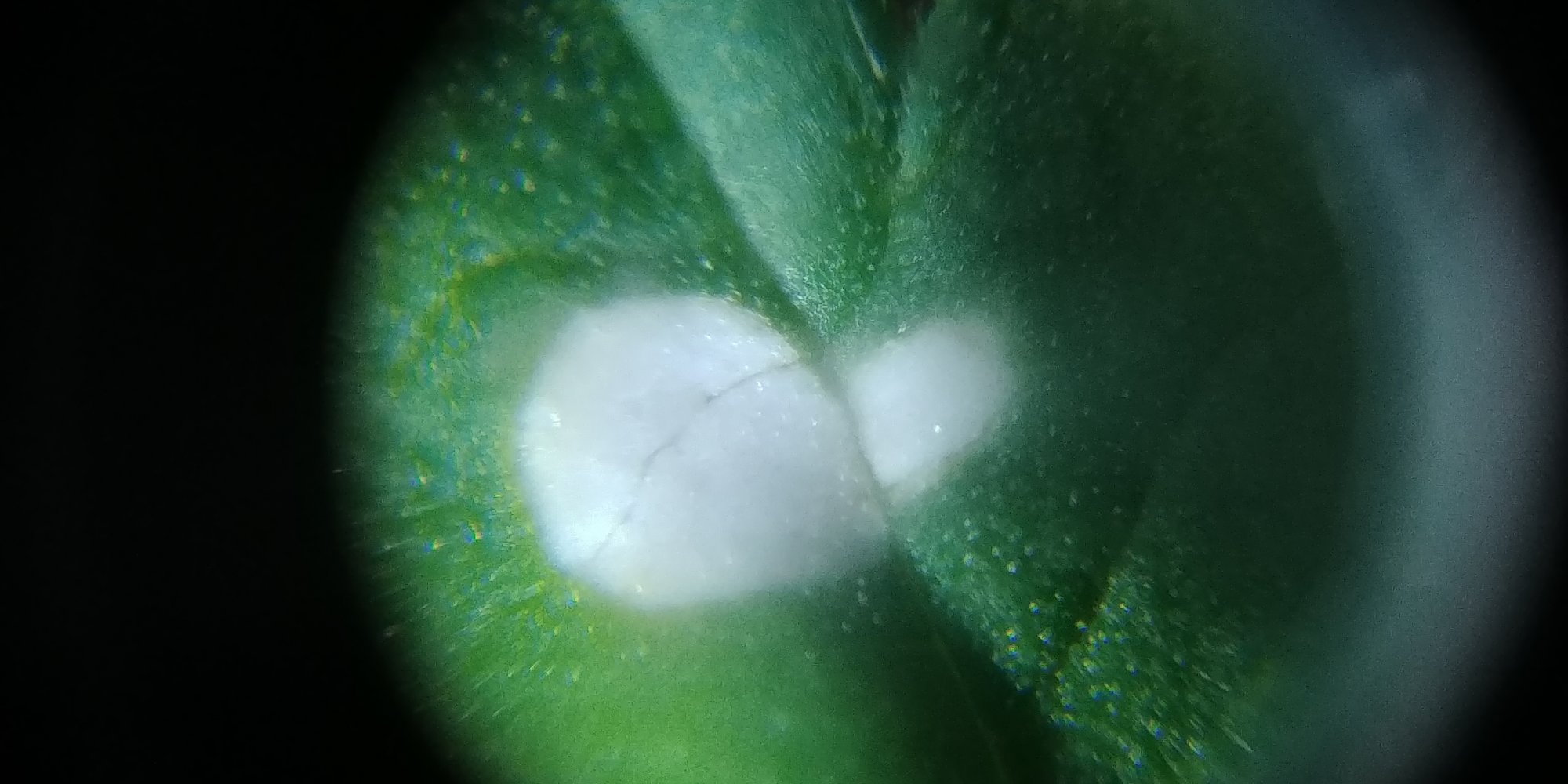 White spots need second opinion 2