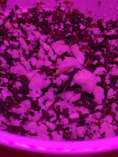 A coco miracle after 5 hydro miscarries.