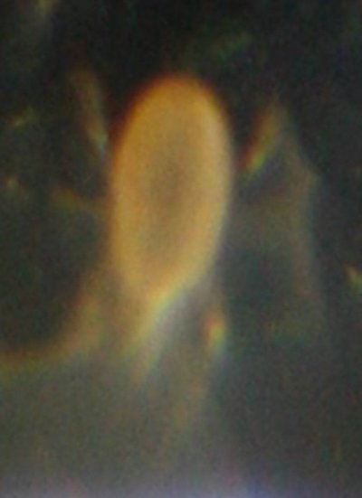 RA or soil mite scope 3.jpg