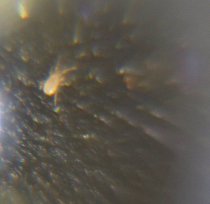 RA or soil mite scope 1.jpg