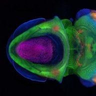 cephalopod