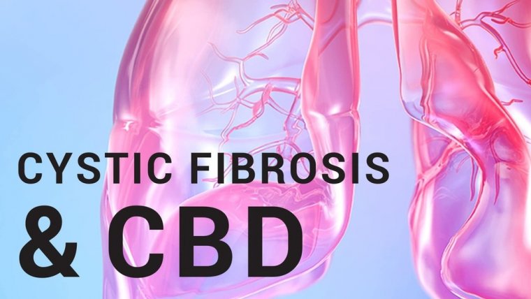 Cystic Fibrosis and Cannabis: How Do They Fit Together?