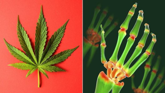 Does Cannabis Help Patients With Rheumatoid Arthritis?