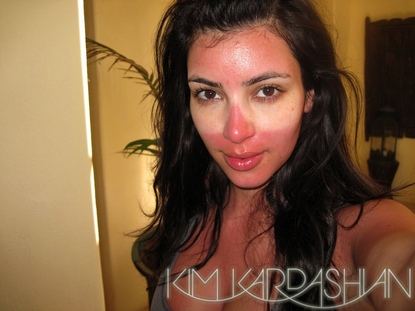 kim-kardashian-sunburn.JPG