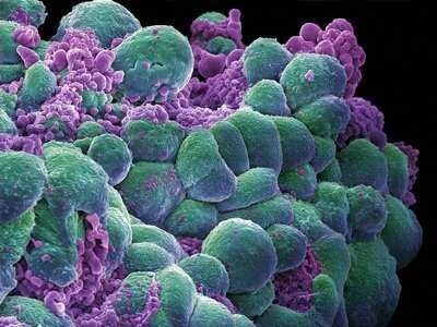 a-chemical-found-in-marijuana-stops-cancer-cells-from-spreading-in-the-lab.jpg