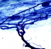 15Mycorrhiza.jpg